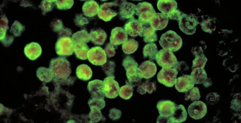 Ameba Naegleria fowleri, conhecida popularmente como ameba “comedora de cérebro” Foto: CDC/ Dr. Govinda S. Visvesvara