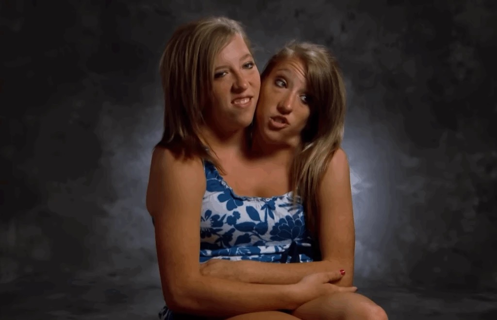Abby e Brittany Hensel Foto: Reprodução/YouTube Origin