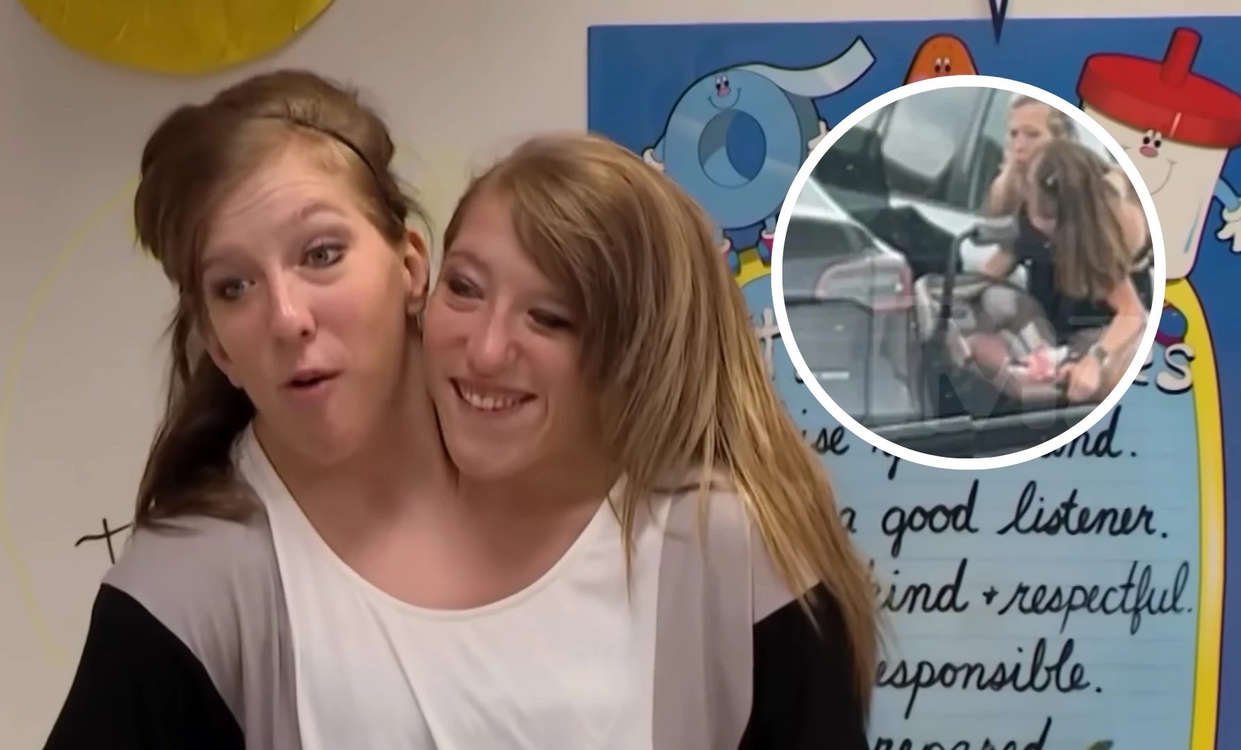 Gêmeas siamesas com cadeira de bebê Fotos: Reprodução/YouTube Origin // TMZ