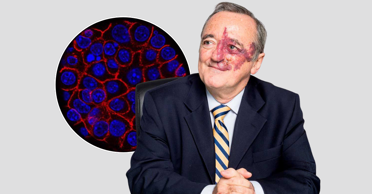 Mariano Barbacid autor do estudo espanhol que apontou eliminação total de tumores pancreáticos em modelos animais 